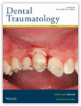 Dental Traumatology